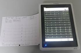  EKG 12 chanel Comen  H12 without trolley 